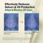 تصویر روغن پاک‌کننده منافذ آنوا (Pore Control) در فروشگاه لیورا