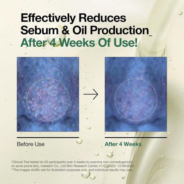 تصویر روغن پاک‌کننده منافذ آنوا (Pore Control) در فروشگاه لیورا